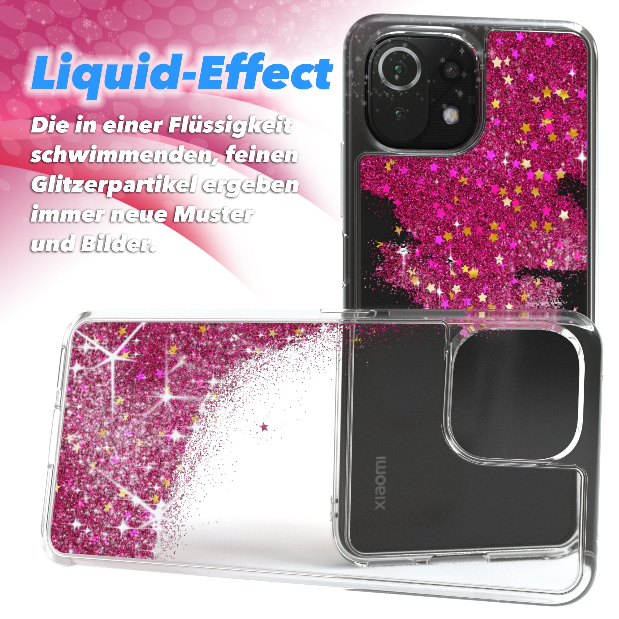 Xiaomi Mi 11 Lite / 5G / 11 Lite 5G NE Glitzerhülle